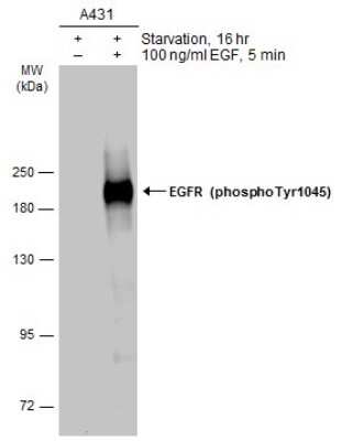 Western Blot: EGFR [p Tyr1045] Antibody [NBP3-13266]